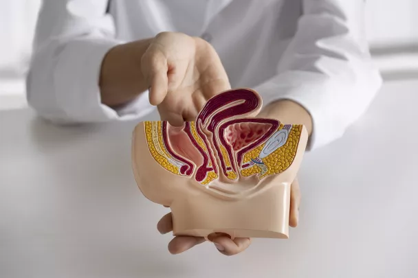 CANCER COLON